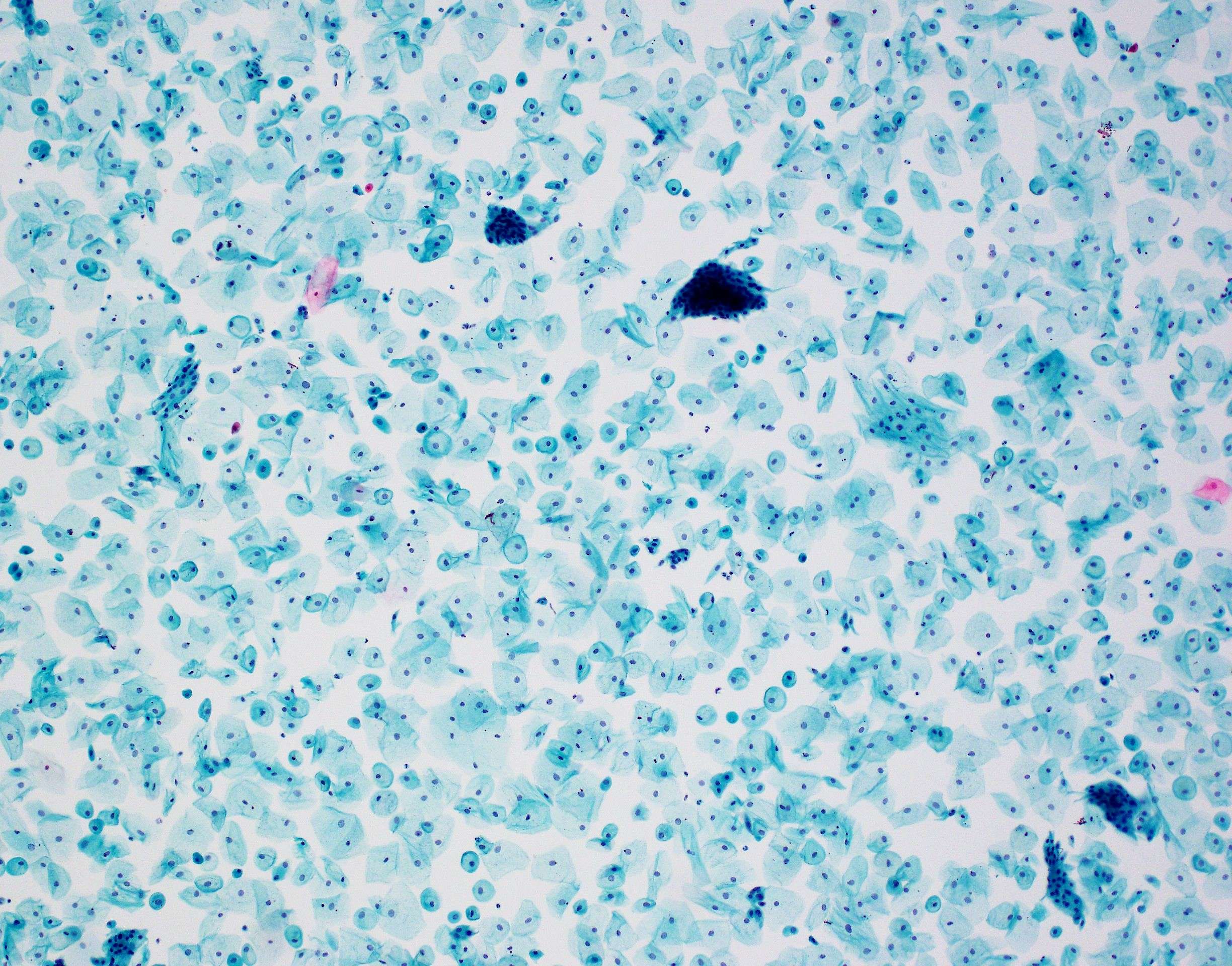C146 21 luteal phase