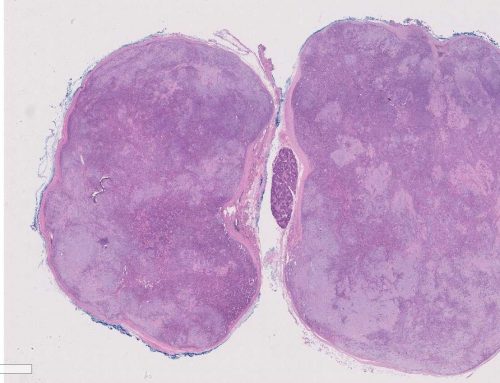 Pleomorphic adenoma